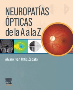 Neuropatías ópticas de la A a la Z