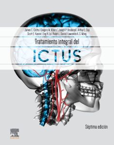 Tratamiento integral del ictus