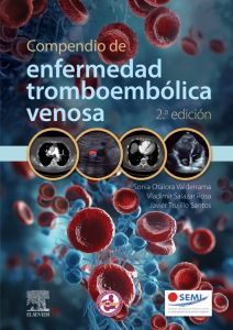 Compendio de enfermedad tromboembólica venosa