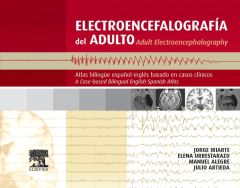 Electroencefalografía del adulto