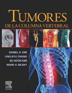 Tumores de la columna vertebral