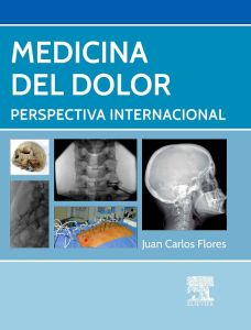 Medicina del dolor