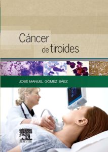 Cáncer de tiroides