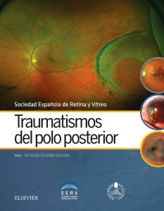 Traumatismos del polo posterior