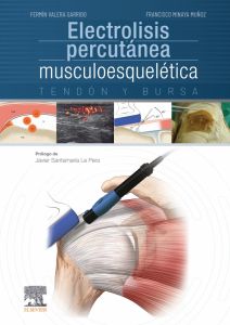 Electrolisis percutánea musculoesquelética