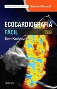 Ecocardiografía fácil