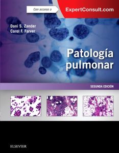 Patología pulmonar