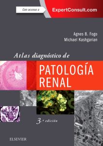 Atlas diagnóstico de patología renal