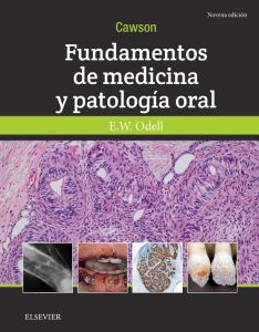 Cawson.Fundamentos de medicina y patología oral