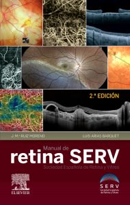 Manual de retina SERV