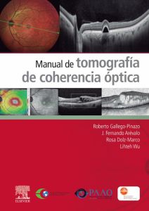 Manual de tomografía de coherencia óptica