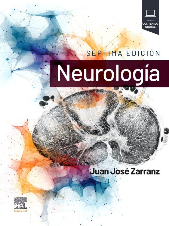 Neurología - 9788413822792