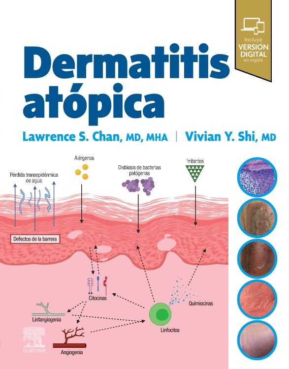 Dermatitis Atópica 9788413824413 1369