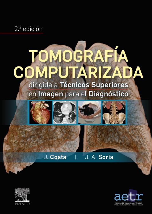 Tomografía Computarizada Dirigida A Técnicos Superiores En Imagen Para ...