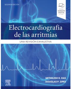 Electrocardiografía de las arritmias