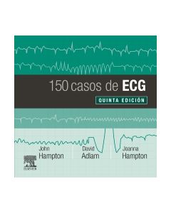 150 casos de ECG