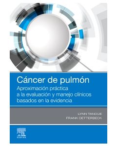 Cáncer de pulmón