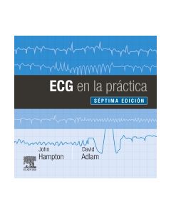 ECG en la práctica