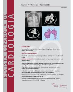 Revista Española de Cardiología